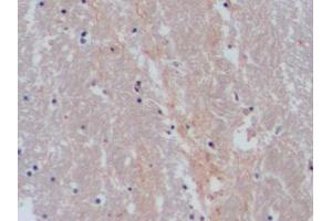 Immunohistochemistry (IHC) image for anti-Solute Carrier Family 6 (Neurotransmitter Transporter, serotonin), Member 4 (SLC6A4) (AA 181-252) antibody (ABIN7435223)