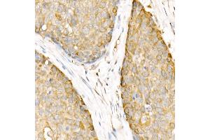 Immunohistochemistry (IHC) image for anti-Ligase III, DNA, ATP-Dependent (LIG3) (AA 730-1009) antibody (ABIN6143207)