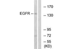 Western blot analysis of extracts from A431 cells, treated with EGF 40myM 10', using EGFR (Ab-1197) Antibody. (EGFR 抗体  (AA 1161-1210))