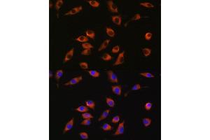 Immunofluorescence analysis of L929 cells using SYT12 antibody (ABIN7270678) at dilution of 1:100. (SYT12 抗体  (AA 95-200))