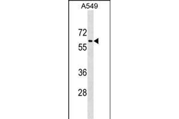 TRAM1L1 anticorps  (C-Term)