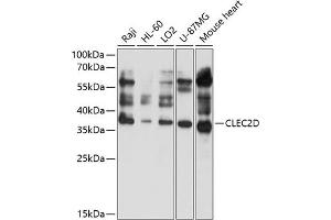 Western blot analysis of extracts of various cell lines, using CLEC2D antibody (ABIN6130113, ABIN6138707, ABIN6138708 and ABIN6214667) at 1:1000 dilution. (CLEC2D 抗体  (AA 60-154))