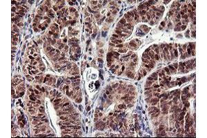 Image no. 2 for anti-Tumor Protein P73 (TP73) (AA 167-409) antibody (ABIN1491006) (Tumor Protein p73 抗体  (AA 167-409))