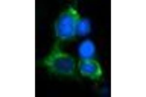 Image no. 2 for anti-Myelin Protein Zero-Like 2 (MPZL2) antibody (ABIN1499552) (MPZL2 抗体)