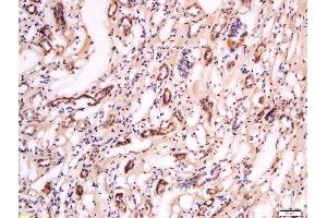 Formalin-fixed and paraffin embedded human kidney labeled with Anti- Pan FOXD Polyclonal Antibody, Unconjugated  at 1:200 followed by conjugation to the secondary antibody and DAB staining. (FOXD (AA 131-230) 抗体)