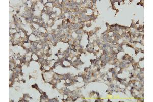Immunostaining (ISt) image for anti-Related RAS Viral (R-Ras) Oncogene Homolog 2 (RRAS2) (AA 1-204) antibody (ABIN564936)