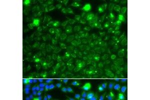 Immunofluorescence analysis of A549 cells using HSPE1 Polyclonal Antibody (HSPE1 抗体)