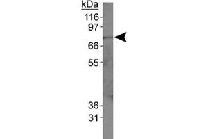 Western blot analysis of ACSL1 in HepG2 whole cell lysates using ACSL1 polyclonal antibody . (ACSL1 抗体  (AA 1-100))