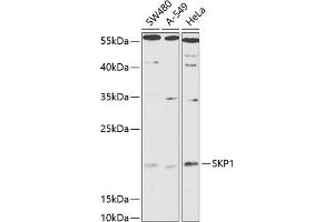 Western blot analysis of extracts of various cell lines, using SKP1 antibody (ABIN6130683, ABIN6147817, ABIN6147819 and ABIN6216158) at 1:1000 dilution. (SKP1 抗体  (AA 1-163))
