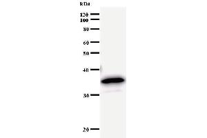 Western Blotting (WB) image for anti-Bromodomain Containing 3 (BRD3) antibody (ABIN933105) (BRD3 抗体)