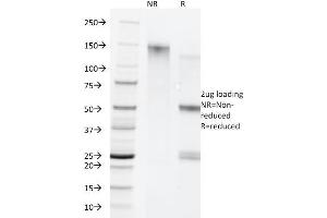 SDS-PAGE Analysis Purified Cytokeratin 5/8 Monoclonal Antibody (C-50). (Keratin 5/8 抗体)