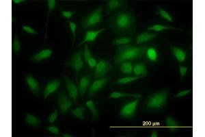 Immunofluorescence of monoclonal antibody to TYMS on HeLa cell. (TYMS 抗体  (AA 111-210))