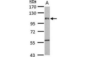 Western Blotting (WB) image for anti-Egf-Like Module Containing, Mucin-Like, Hormone Receptor-Like 1 (EMR1) (AA 626-886) antibody (ABIN784004)
