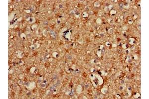 Immunohistochemistry of paraffin-embedded human brain tissue using ABIN7170654 at dilution of 1:100 (SPRY2 抗体  (AA 2-97))