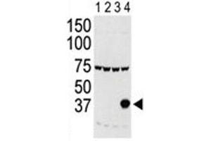 Western blot testing of Aurora-C antibody and lysate of 293 cells expressing 1) Flag tag, 2) Flag-tagged -A, 3) -B and 4) Aurora-C. (Aurora Kinase C 抗体  (AA 1-30))