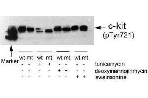 Image no. 1 for anti-Mast/stem Cell Growth Factor Receptor (KIT) (pTyr721) antibody (ABIN196993) (KIT 抗体  (pTyr721))