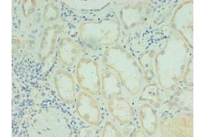 Immunohistochemistry (IHC) image for anti-Retinol Dehydrogenase 12 (All-Trans/9-Cis/11-Cis) (RDH12) (AA 1-316) antibody (ABIN7167836)