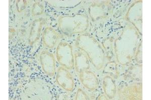 Immunohistochemistry of paraffin-embedded human kidney tissue using ABIN7167836 at dilution of 1:100 (RDH12 抗体  (AA 1-316))