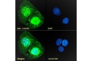(ABIN263205) Immunofluorescence analysis of paraformaldehyde fixed A431 cells, permeabilized with 0. (CTDSPL 抗体  (Internal Region))