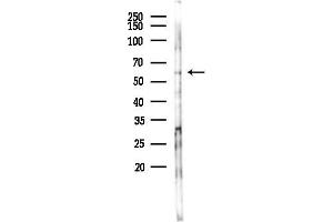 Western blot analysis of lysates from K562 cells(UV 30 min treatment), using Phospho-AK (Thr308) Antibody at 1/1000 dilution.