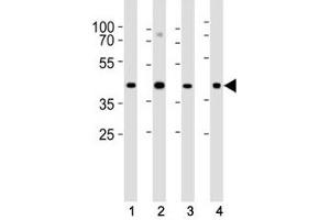 Western blot analysis of lysate from (1) HeLa, (2) U-87 MG, (3) rat C6 cell line and (4) mouse heart tissue lysate using Connexin 43 antibody at 1:1000. (Connexin 43/GJA1 抗体  (AA 107-138))