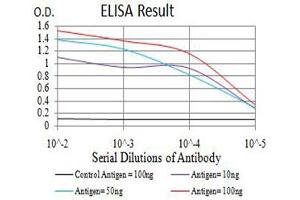 Black line: Control Antigen (100 ng),Purple line: Antigen (10 ng), Blue line: Antigen (50 ng), Red line:Antigen (100 ng) (GRM7 抗体  (AA 454-590))