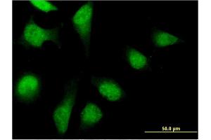 Immunofluorescence of monoclonal antibody to PFDN2 on HeLa cell. (PFDN2 抗体  (AA 1-154))