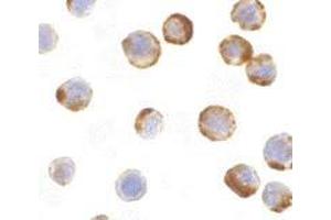 Immunocytochemistry of caspase-6 in MCF7 with AP30201PU-N caspase-6 antibody at 1 μg/ml. (Caspase 6 抗体  (Intermediate Domain))