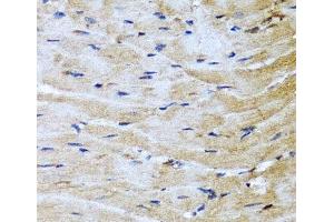 Immunohistochemistry of paraffin-embedded Mouse heart using M6PR Polyclonal Antibody at dilution of 1:100 (40x lens). (M6PR 抗体)