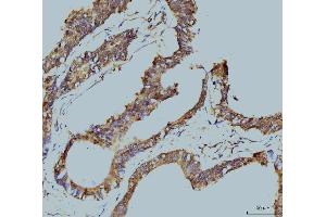 IHC analysis of TBP-1/PSMC3 using anti-TBP-1/PSMC3 antibody (ABIN7599392).