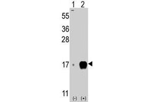 Western blot analysis of IFITM3 (arrow) using rabbit IFITM3 polyclonal antibody . (IFITM3 抗体  (Internal Region))