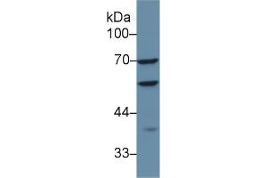 Detection of CAP1 in Human HepG2 cell lysate using Polyclonal Antibody to Adenylyl Cyclase Associated Protein 1 (CAP1) (CAP1 抗体  (AA 38-149))