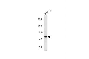 Anti-MUC20 Antibody (C-term) at 1:1000 dilution + Human lung tissue lysate Lysates/proteins at 20 μg per lane. (MUC20 抗体  (C-Term))