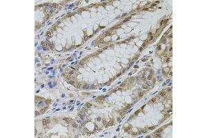 Immunohistochemistry of paraffin-embedded human stomach using MAPK1 antibody. (ERK2 抗体  (AA 200-300))