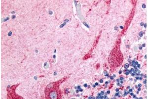 Human Brain, Cerebellum (formalin-fixed, paraffin-embedded) stained with PRKCZ antibody ABIN213577 at 2. (PKC zeta 抗体  (N-Term))