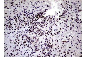 Image no. 2 for anti-Nibrin (NBN) (AA 183-460) antibody (ABIN1491066) (Nibrin 抗体  (AA 183-460))