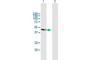 Western Blot analysis of TBC1D16 expression in transfected 293T cell line by TBC1D16 MaxPab polyclonal antibody. (TBC1D16 抗体  (AA 1-405))
