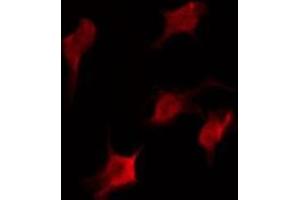 ABIN6275979 staining COLO205 by IF/ICC. (CasLTR2 抗体  (Internal Region))