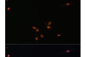 Immunofluorescence analysis of C6 cells using SMAD7 Polyclonal Antibody at dilution of 1:100. (SMAD7 抗体)