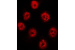Immunofluorescence (fixed cells) (IF/ICC) image for anti-Protein tyrosine Phosphatase, Non-Receptor Type 11 (PTPN11) (pTyr542) antibody (ABIN6256761)