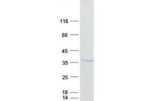 Western Blotting (WB) image for Protein Phosphatase 1, Regulatory (Inhibitor) Subunit 1B (PPP1R1B) (Transcript Variant 2) protein (Myc-DYKDDDDK Tag) (ABIN2719225)