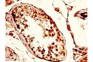 IHC image of ABIN7171526 diluted at 1:200 and staining in paraffin-embedded human testis tissue performed on a Leica BondTM system. (TPX2 抗体  (AA 160-320))