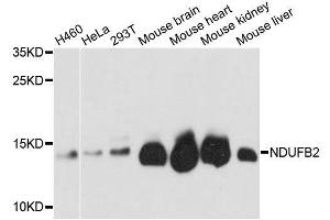 Western blot analysis of extracts of various cell lines, using NDUFB2 antibody. (NDUFB2 抗体  (AA 34-105))