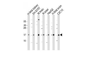 All lanes : Anti-Autophagy GABAR Antibody (N-term) at 1:1000-1 :2000 dilution Lane 1: human fetal kidney lysate Lane 2: SH-SY5Y whole cell lysate Lane 3: mouse brain lysate Lane 4: rat brain whole cell lysate Lane 5: HepG2 whole cell lysate Lane 6: human fetal brain lysate Lane 7: C2C12 whole cell lysate Lysates/proteins at 20 μg per lane. (GABARAP 抗体  (AA 1-30))