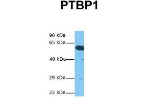 Host:  Rabbit  Target Name:  PTBP1  Sample Tissue:  Human HepG2  Antibody Dilution:  1. (PTBP1 抗体  (N-Term))