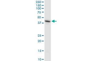 HS6ST1 monoclonal antibody (M05A), clone 1H4. (HS6ST1 抗体  (AA 303-401))