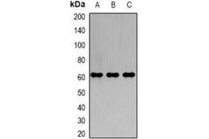 Western blot analysis of IRSp53 expression in A549 (A), K562 (B), SW620 (C) whole cell lysates. (BAIAP2 抗体)