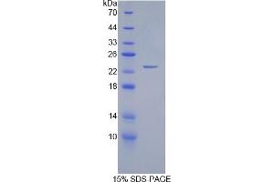 SDS-PAGE of Protein Standard from the Kit  (Highly purified E. (GREM1 ELISA 试剂盒)