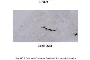 Sample Type : Frog brain Primary Antibody Dilution : 1:500 Secondary Antibody : Biotinylated goat anti-rabbit Secondary Antibody Dilution : 1:200 Color/Signal Descriptions : Black: EGR1 Gene Name : Egr1 a Submitted by : Eva Fischer, Colorado State University (EGR1 抗体  (C-Term))