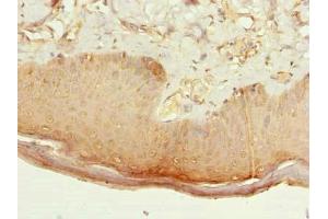 Immunohistochemistry of paraffin-embedded human skin tissue using ABIN7146656 at dilution of 1:100 (CMTR2 抗体  (AA 301-600))